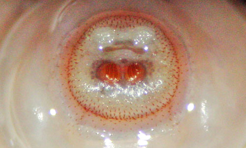 Posterior spiracles of the larva of the human bot fly, Dermatobia hominis (Linnaeus Jr.). 